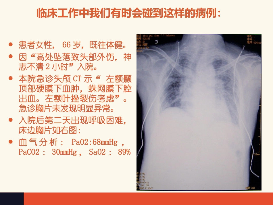 顽固性低氧血症的诊治策略.ppt_第2页