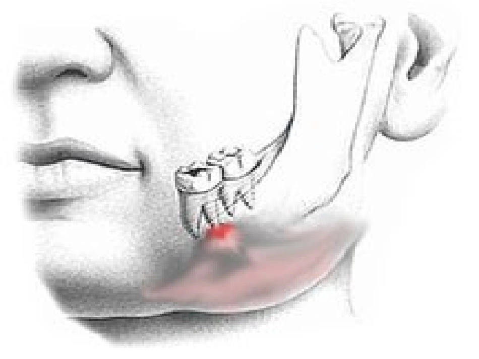 项目牙髓病及-根尖周病.ppt_第1页