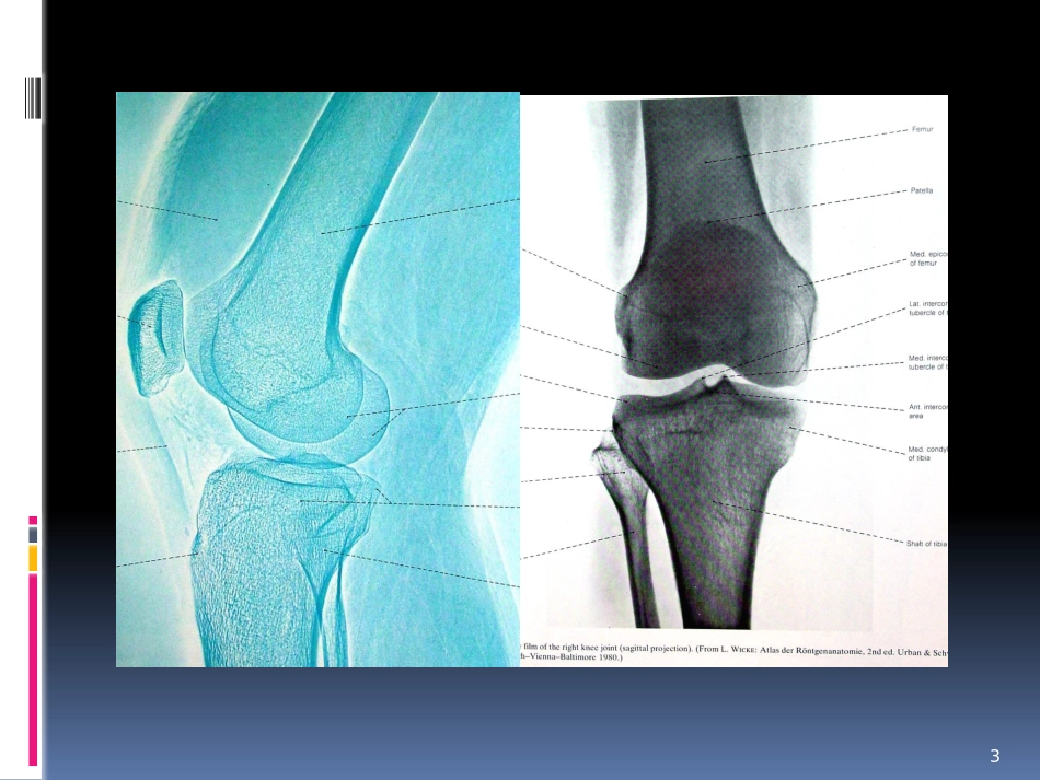 膝关节功能康复.pptx_第3页
