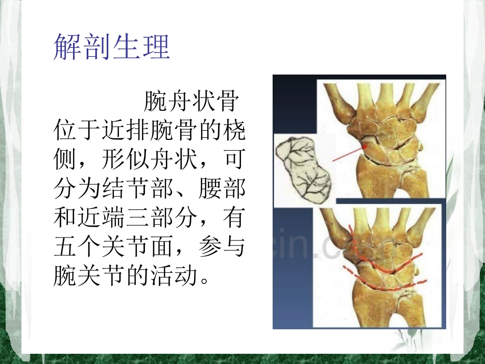 腕舟状骨骨折陈雁华讲义.ppt_第3页