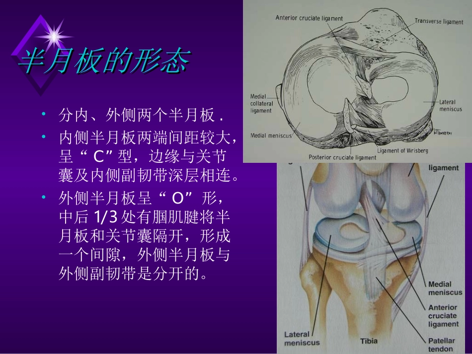 膝关节半月板损伤剖析.ppt_第3页