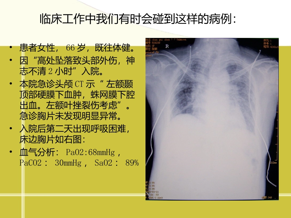 顽固性低氧血症的诊治.ppt_第2页