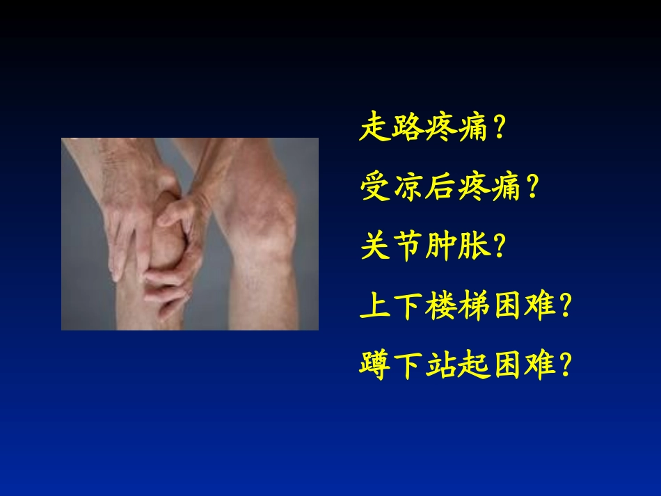 膝骨关节炎科普知识讲座.ppt_第2页