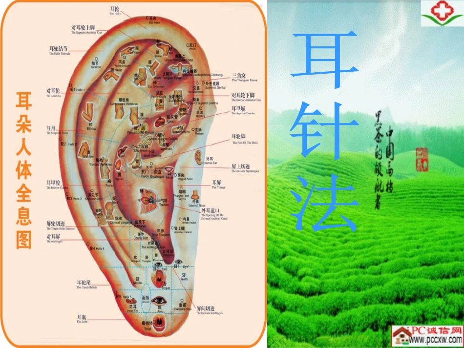 贴耳穴-操作方便非常实用性.ppt_第1页