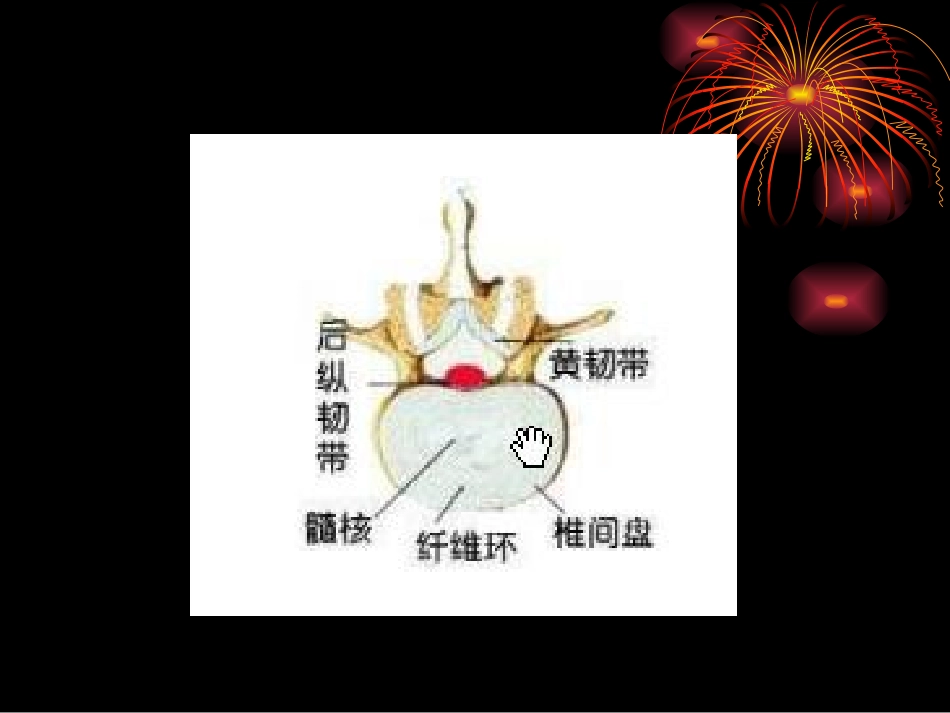 项痹、腰痛-2.ppt_第2页