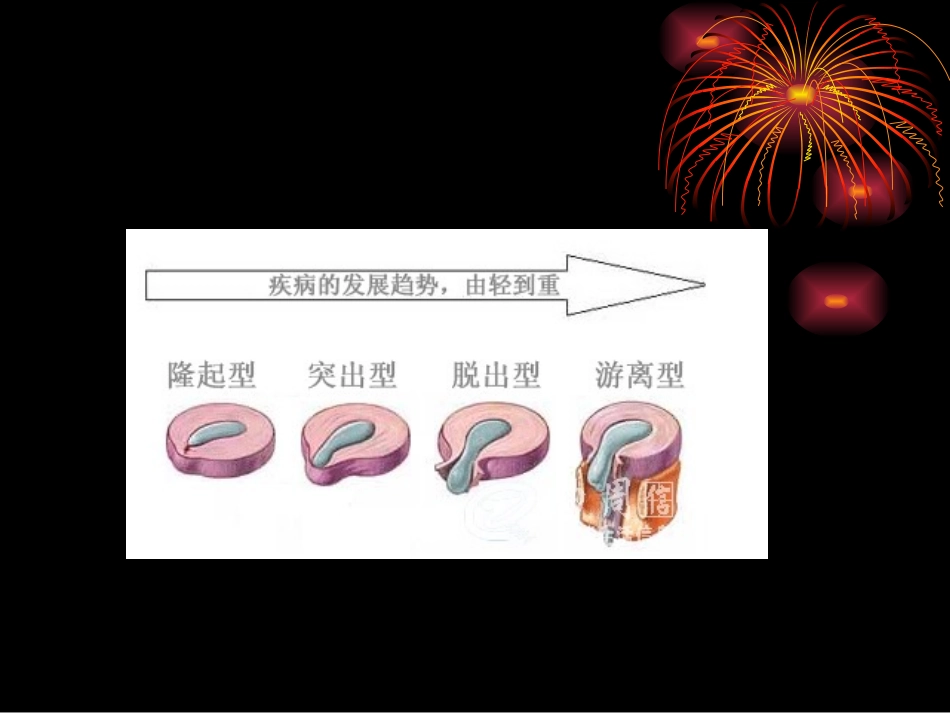 项痹、腰痛-2.ppt_第3页