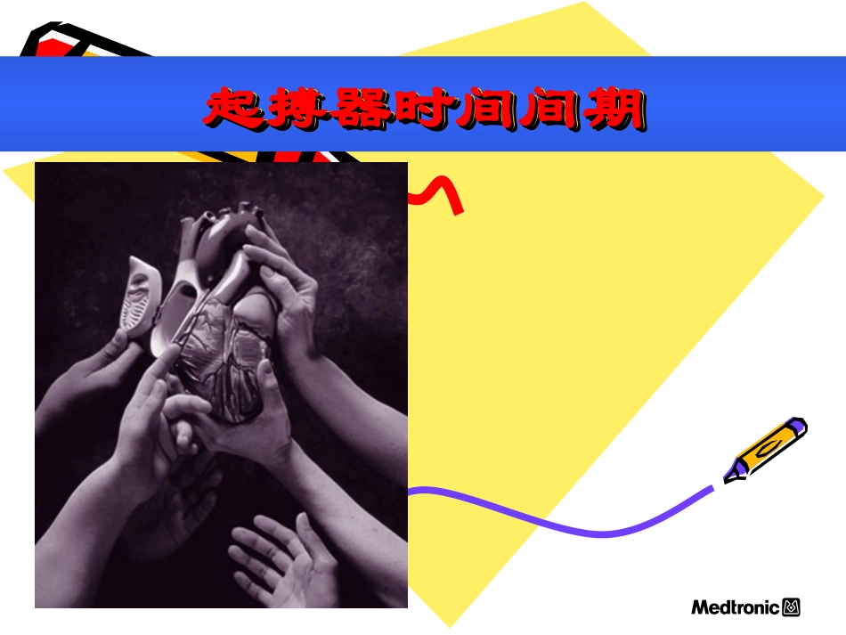 心脏起搏器心电图.ppt_第3页