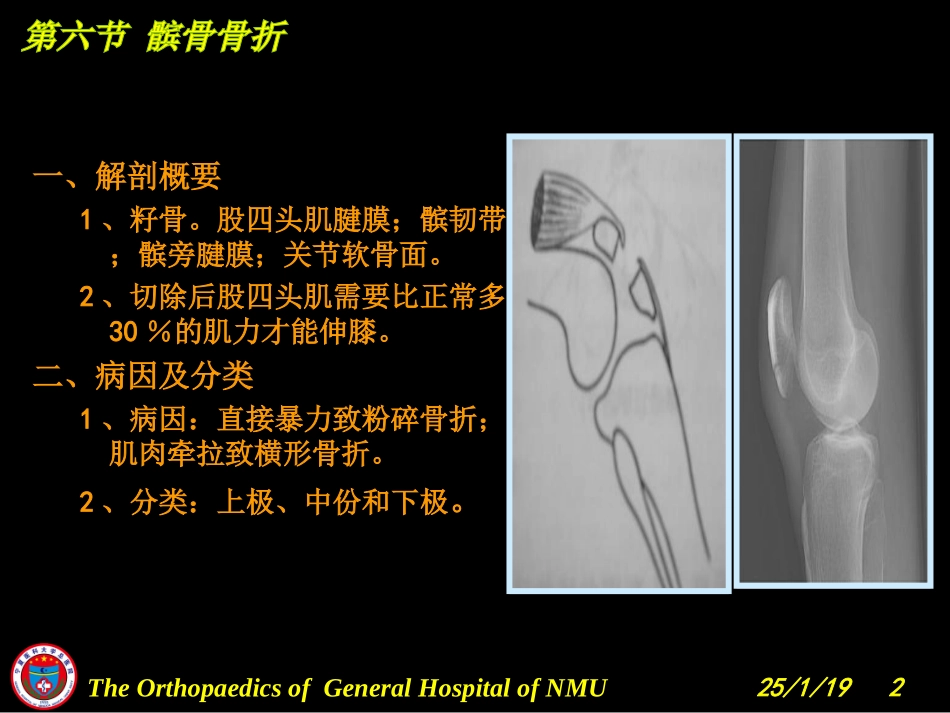 膝关节损伤(韧带、半月板、骨).ppt_第2页