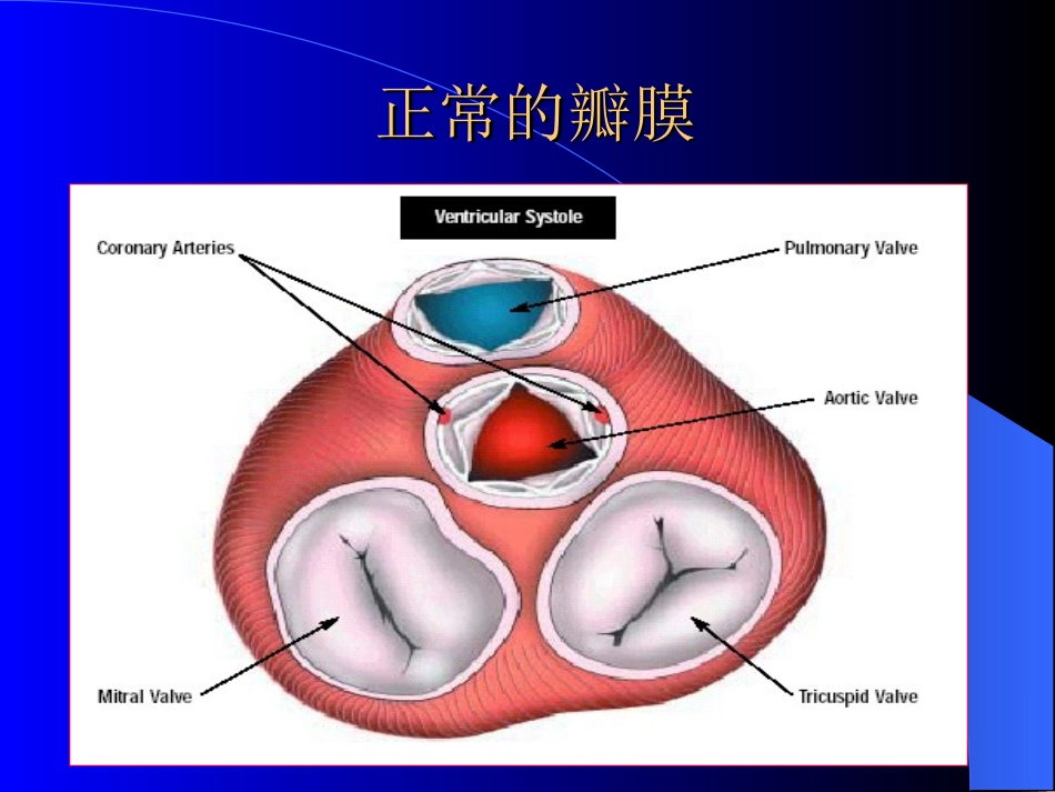 心脏瓣膜病-精品.ppt_第2页