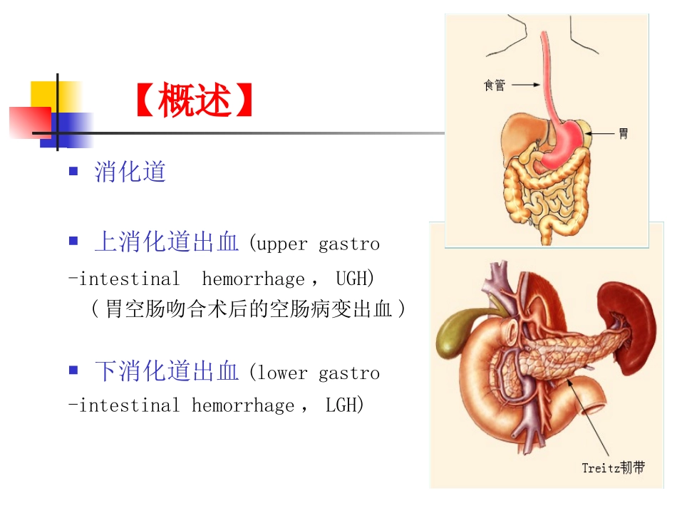 消化道出血进修班课程.ppt_第2页