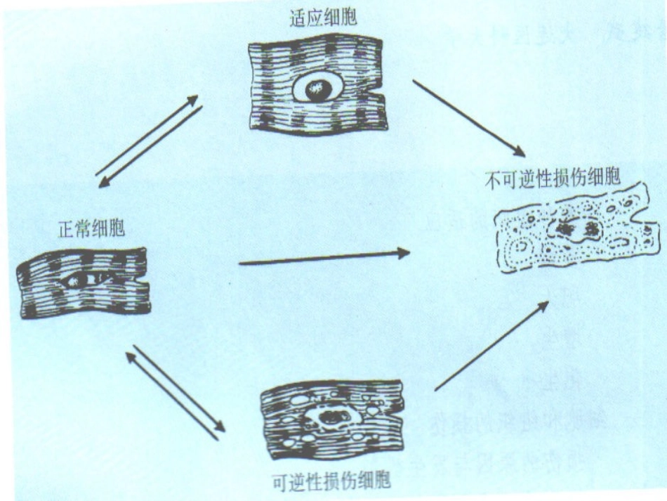 细胞和组织的适应损伤1.ppt_第3页