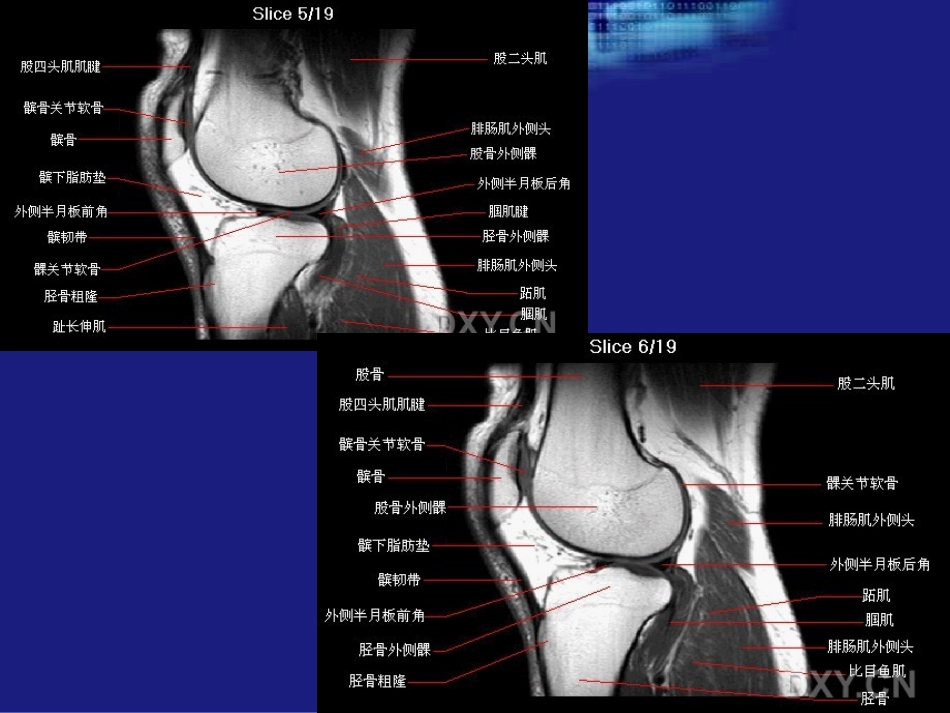 膝关节MRI1.ppt_第2页