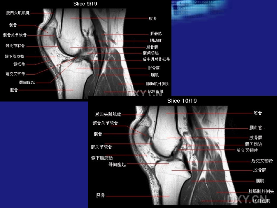 膝关节MRI1.ppt_第3页