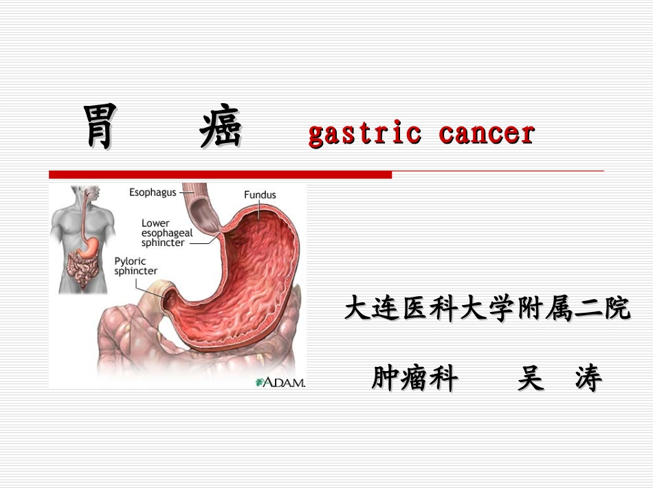 胃癌20091114.ppt_第1页