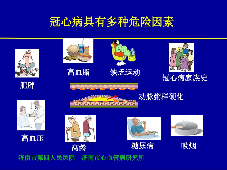 5二型心电图计分系统对诊断冠脉多支病变意义的新评价-.pptx_第3页