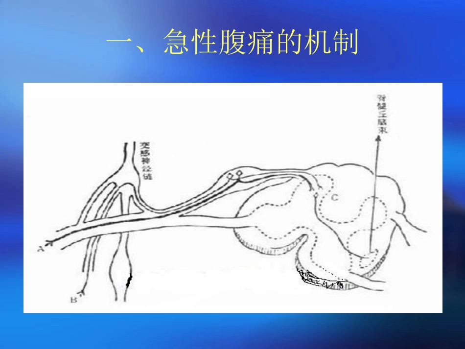 外-科-急-腹-症.ppt_第3页