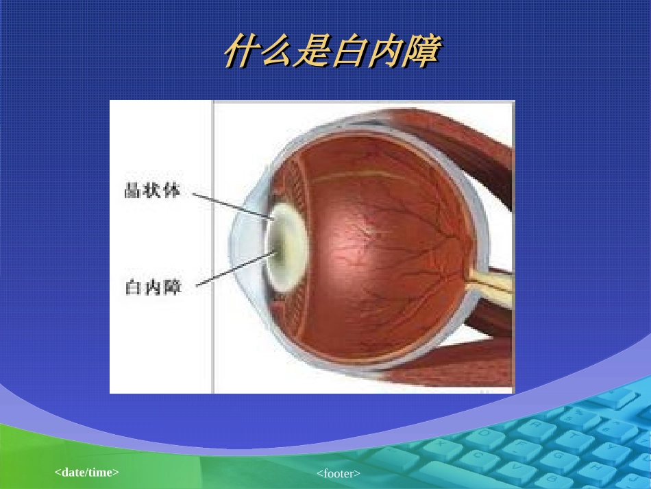 外伤性白内障.ppt_第2页