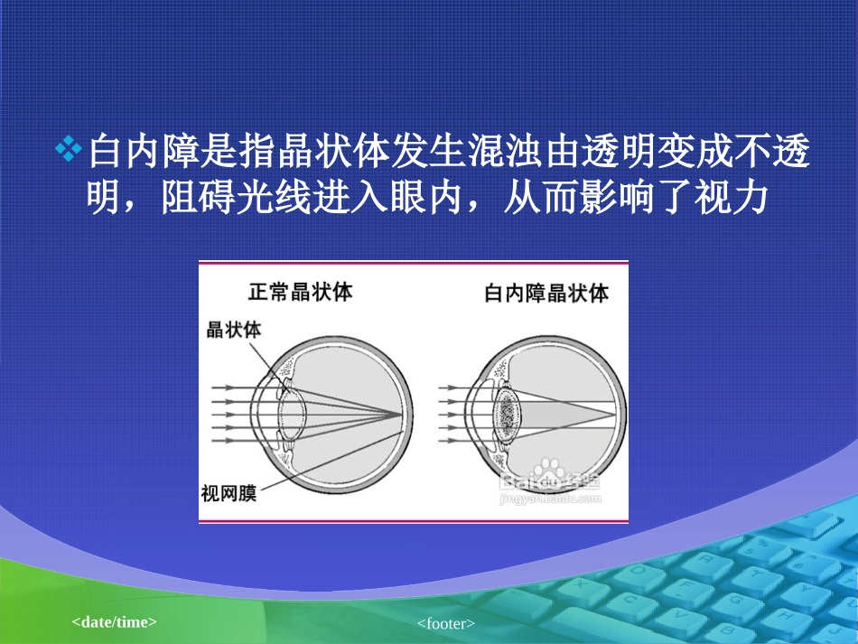 外伤性白内障.ppt_第3页