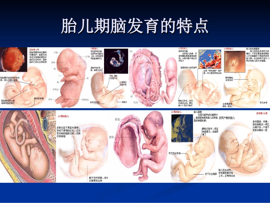 围产期因素与脑损伤ppt-..ppt_第2页