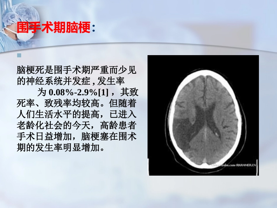 围手术期脑梗.ppt_第2页