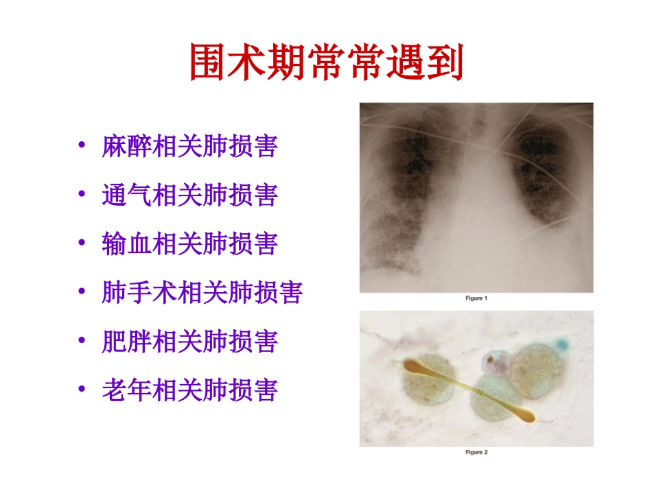 围术期肺损害与肺功能保护.ppt_第3页