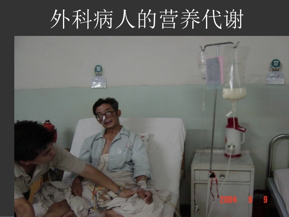 外科病人的营养代谢(精).ppt_第1页