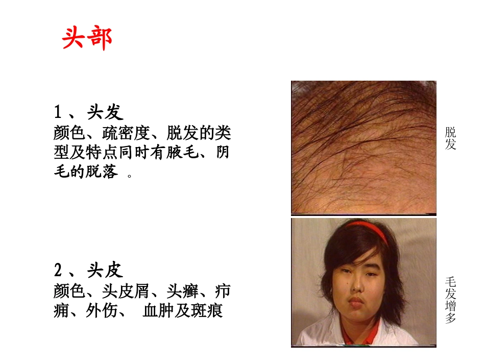 头颈部体格检查.ppt_第2页