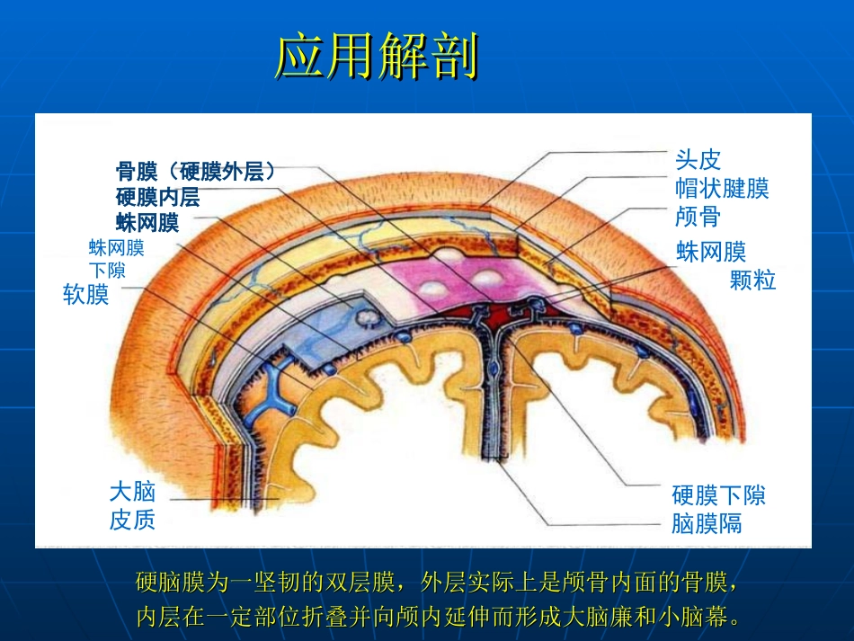 小脑幕硬膜下血肿.ppt_第3页