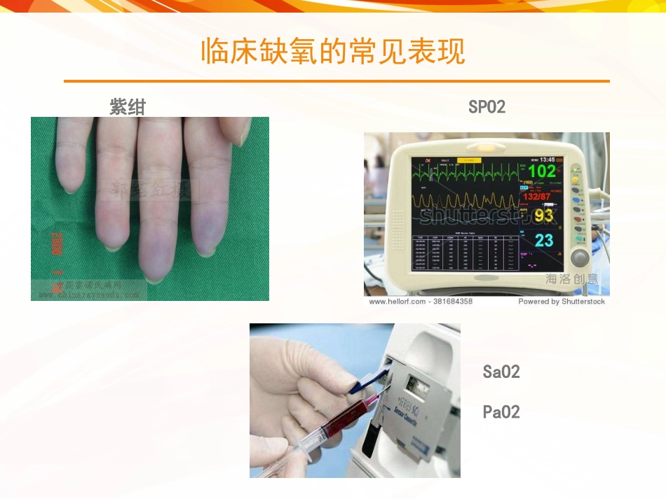 心力衰竭低氧血症.ppt_第2页