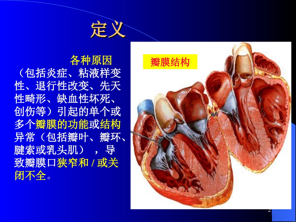 心瓣膜病.ppt_第2页