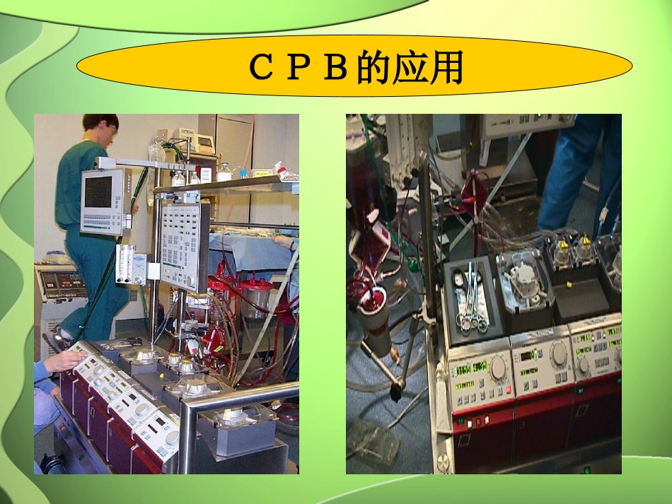 心脏外科术后监护.ppt_第3页