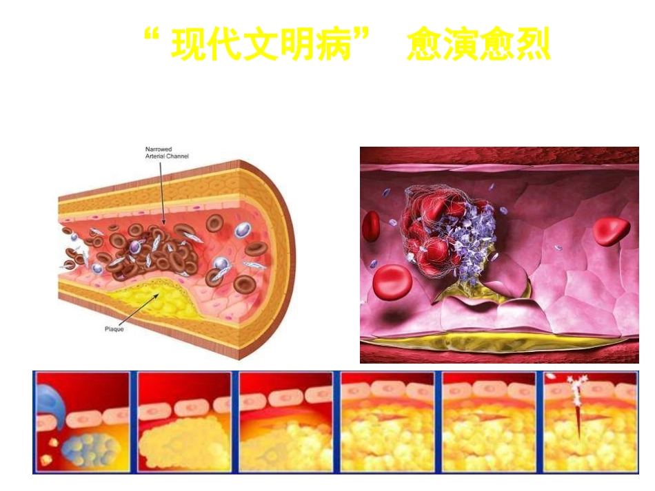 心血管健康讲座.ppt_第3页