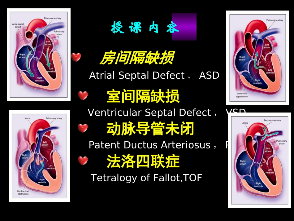 先天性心脏病血液动力学改变.ppt_第3页