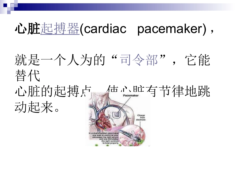 心脏起搏器.ppt_第3页