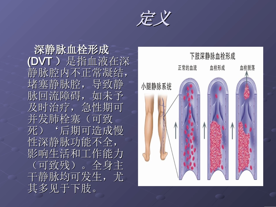 下肢深静脉血栓形.ppt_第2页