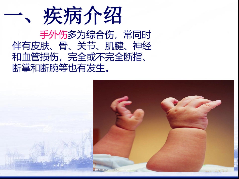 外科手外伤教学查房.ppt_第3页