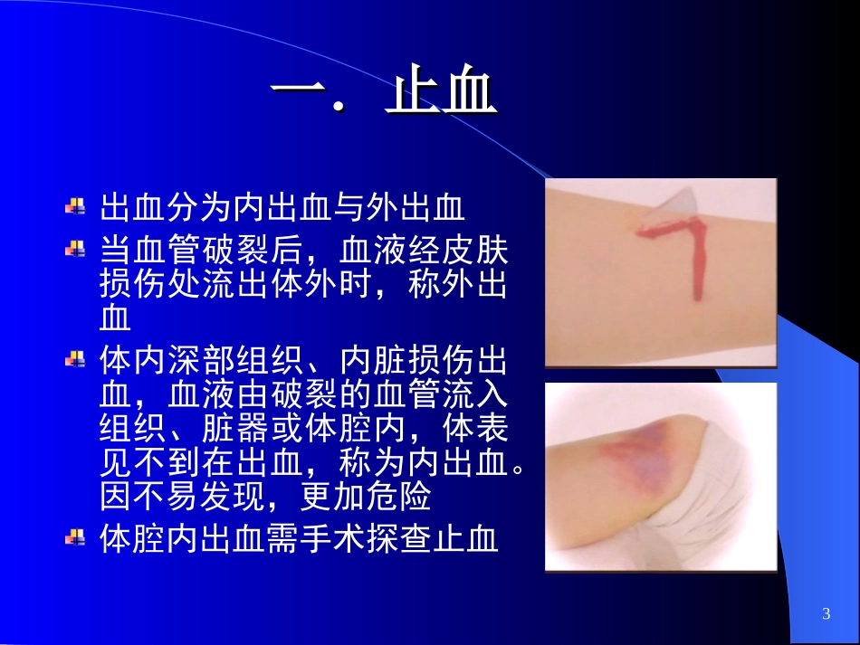 外伤急救止血、固定、转运.ppt_第3页