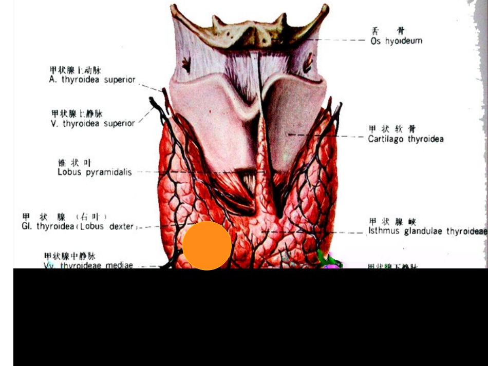 头颈外科常见手术及术后并发症.ppt_第3页