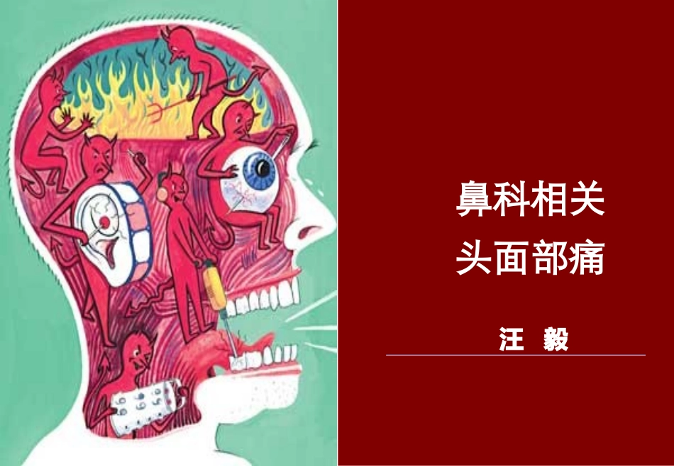 头痛和面部疼痛.ppt_第1页