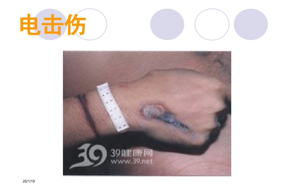 危重症急救.ppt_第2页