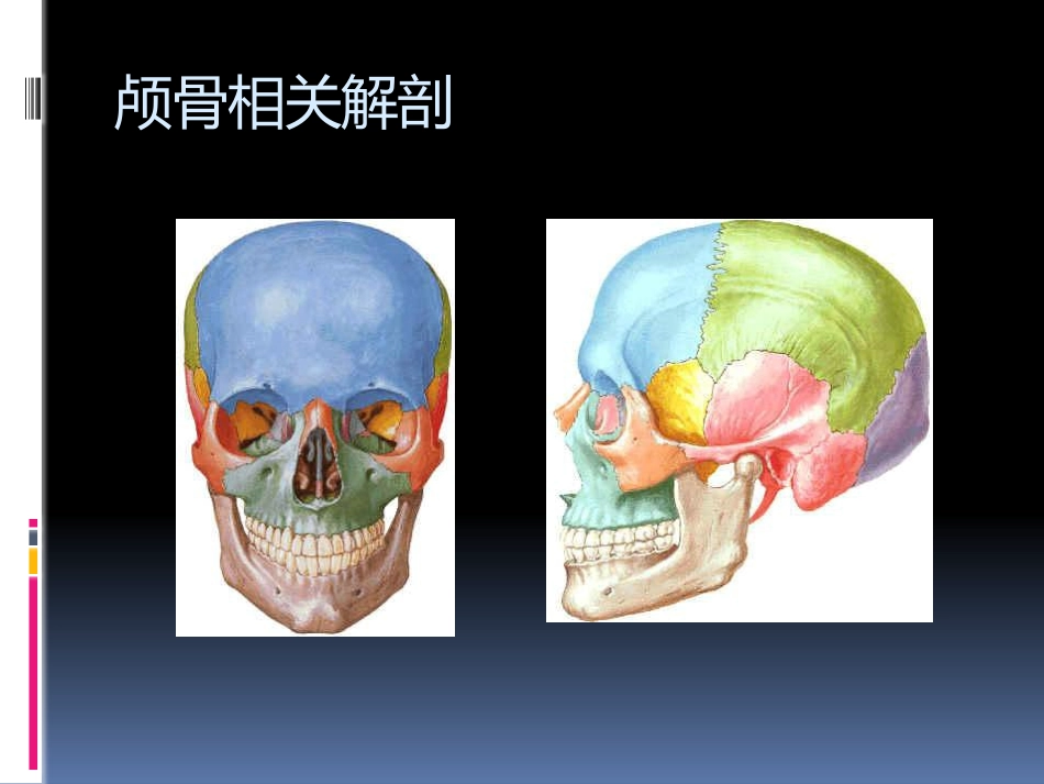 头部外伤CT检查规范.pptx_第2页