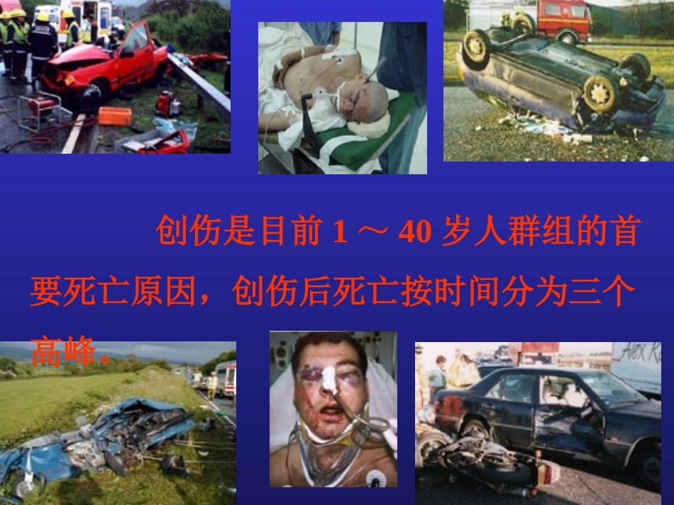 小容量复苏-失血性休克的一种新的液体疗法.ppt_第2页