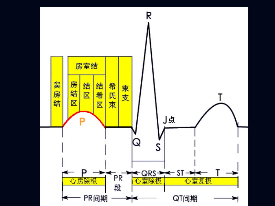 心电图2—肥大缺血.ppt_第2页