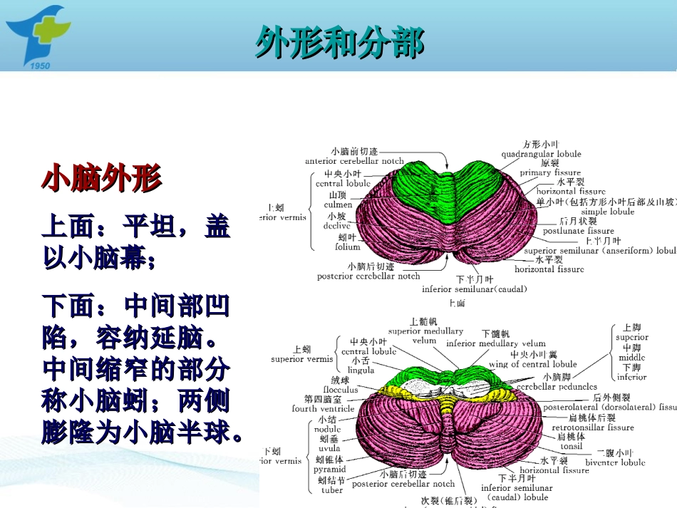 小脑出血诊疗规范.ppt_第3页