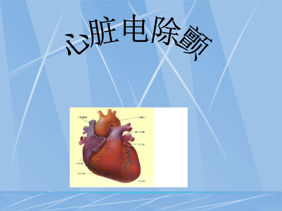 心脏电除颤术.ppt_第1页