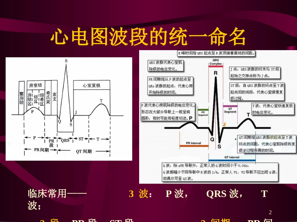心电图-心电向量与心肌缺血.ppt_第1页