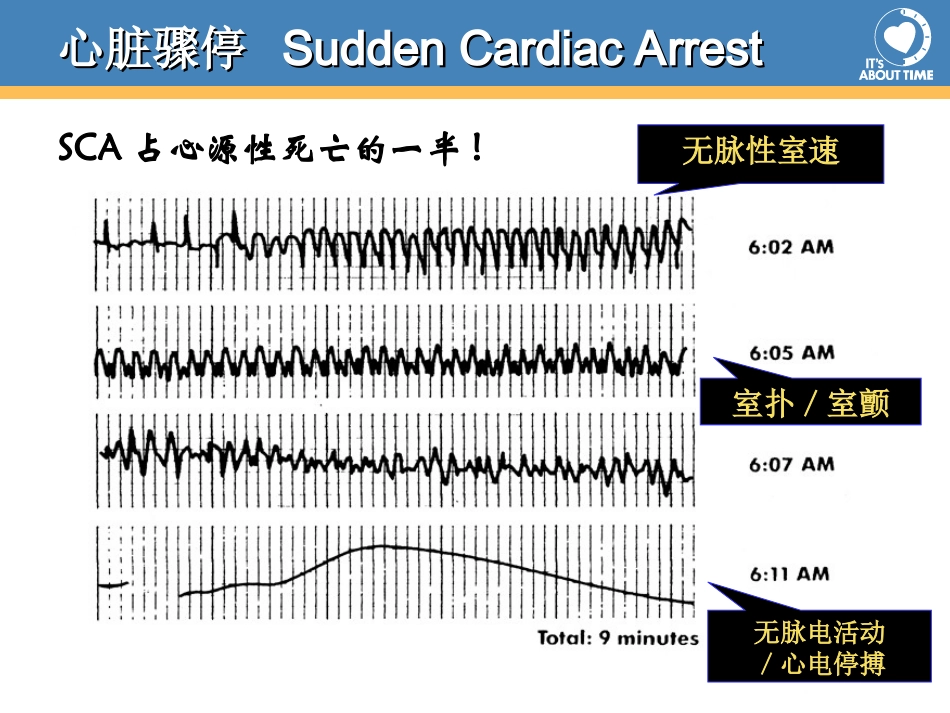 心脏骤停的处理策略.ppt_第2页