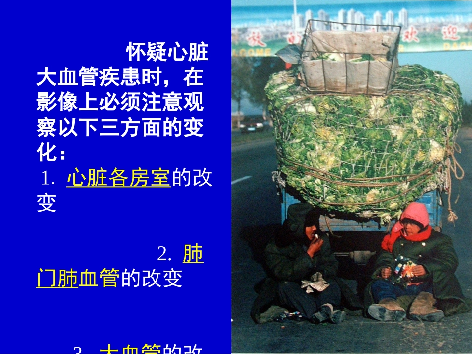 心脏大血管.ppt_第1页