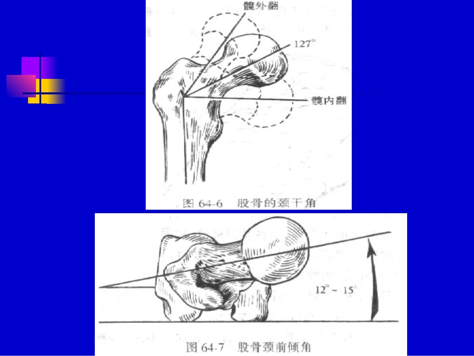 下肢骨折牵引图片2材料.ppt_第3页