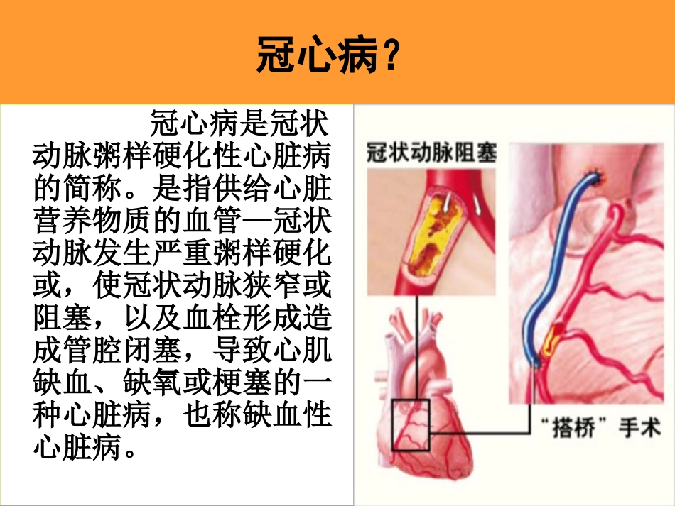 心脏搭桥的健康指导.ppt_第3页
